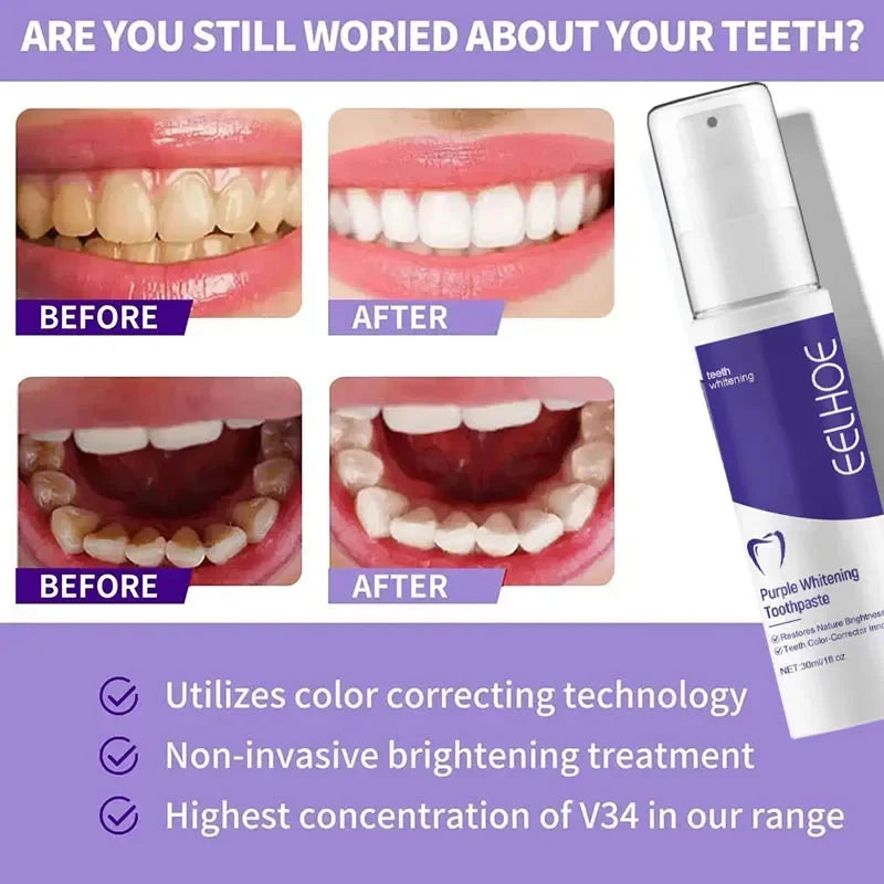 5D Teeth Whitening Toothpaste – Natural Oral Care for Fresh Breath & Stain Removal