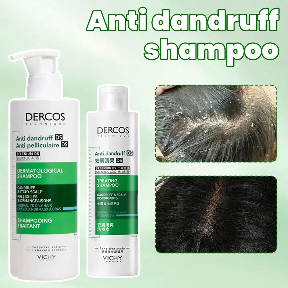 Vichy Anti-Dandruff & Anti-Itch Shampoo – Nourishing, Refreshing, and Soothing for Damaged Hair & Scalp