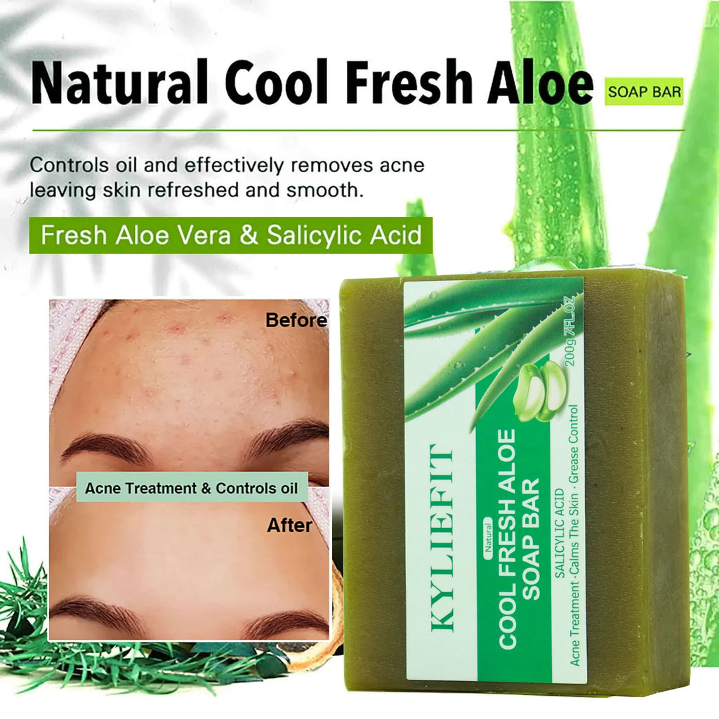 Aloe Brightening Soap Bar 200g – Dark Spot Removal, Acne Control & Oil Balancing for Face and Body