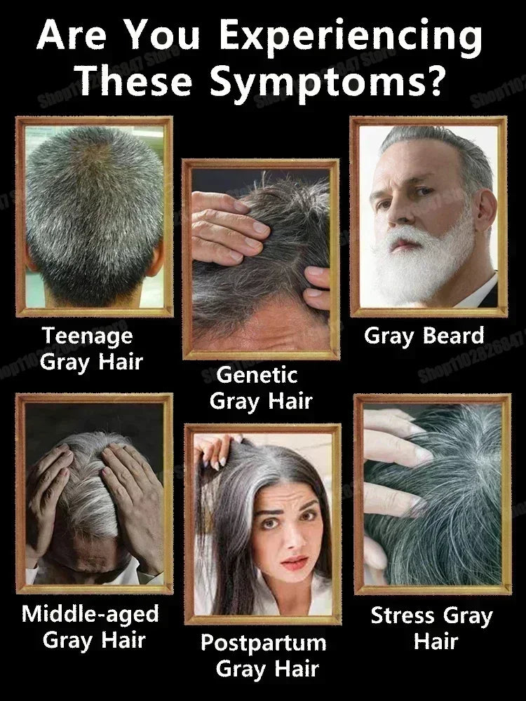 White to Black Gray Hair Serum – Natural Color Repair & Nourishing Essence for Men and Women