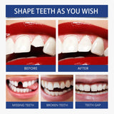 Oralhoe Resin Tooth Repair Glue – Shapeable DIY Temporary Tooth Filling & Gap Repair Kit thumbnail 5