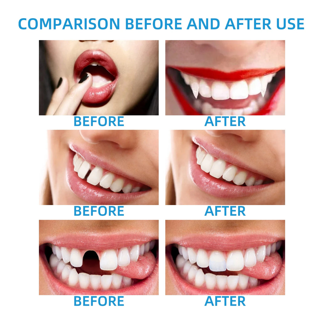 Moldable False Tooth Maker Kit – Temporary Dental Repair Beads for Missing Teeth, Gaps & Cosplay Use – 30ml
