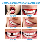 Moldable False Tooth Maker Kit – Temporary Dental Repair Beads for Missing Teeth, Gaps & Cosplay Use – 30ml thumbnail 3