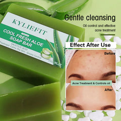 Aloe Brightening Soap Bar 200g – Dark Spot Removal, Acne Control & Oil Balancing for Face and Body