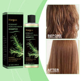 Rosemary Shampoo for Hair Growth, Anti-Dandruff, Soothing Scalp, Repair Split Ends, Nourishing Plant Extracts – 100ml thumbnail 7