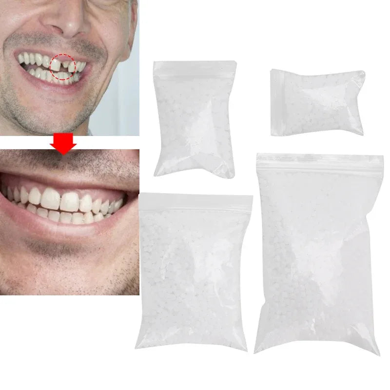 Temporary Tooth Repair Beads – DIY Dental Filling Material for Missing or Broken Teeth