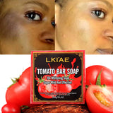 omato Whitening Handmade Natural Soap Bar 200g – Face & Body Brightening, Oil Control, Paraben Free thumbnail 1
