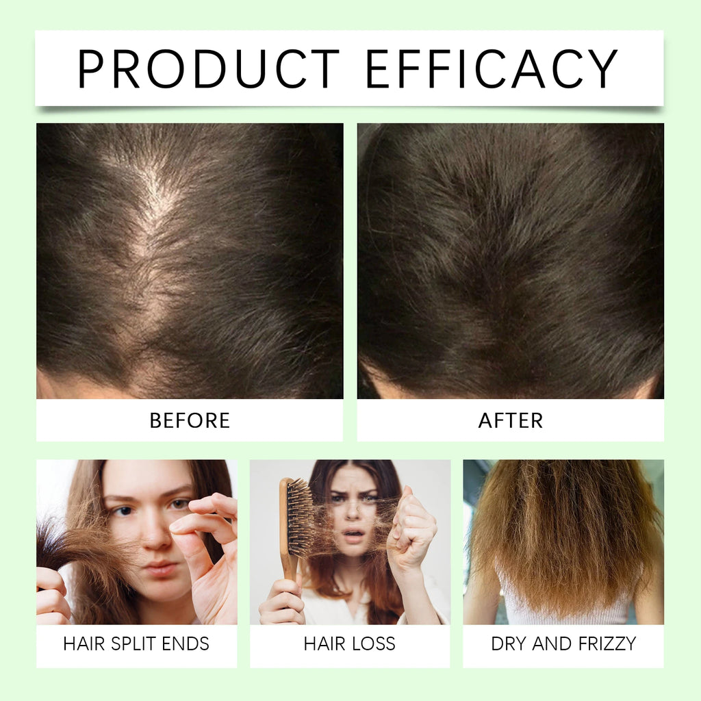 Rosemary Shampoo for Hair Growth, Anti-Dandruff, Soothing Scalp, Repair Split Ends, Nourishing Plant Extracts – 100ml