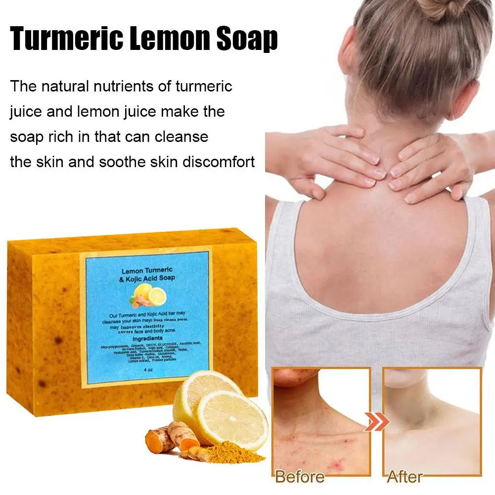 Organic Lemon Turmeric Kojic Acid Soap 100g – Brightening Facial Cleanser for Dark Spots