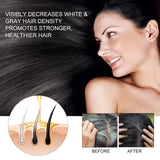 Bamboo Charcoal Shampoo Soap – Deep Cleansing, Nourishing, and Hair Strengthening thumbnail 5