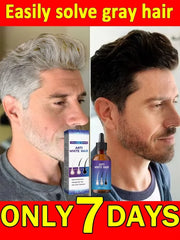White to Black Gray Hair Serum – Natural Color Repair & Nourishing Essence for Men and Women