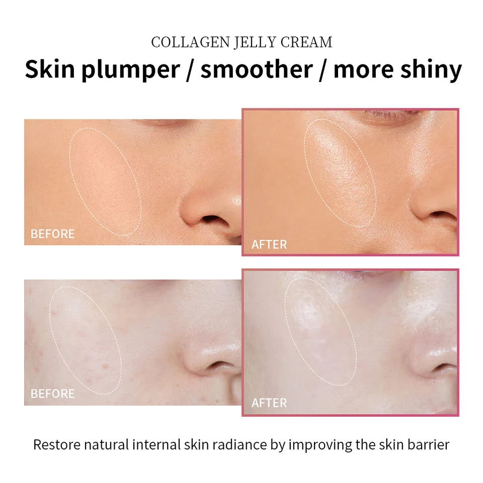 Moisturizing Collagen Jelly Cream with Niacinamide and Hydrolyzed Collagen 100ml Anti-Aging Firming Hydrating Face Cream