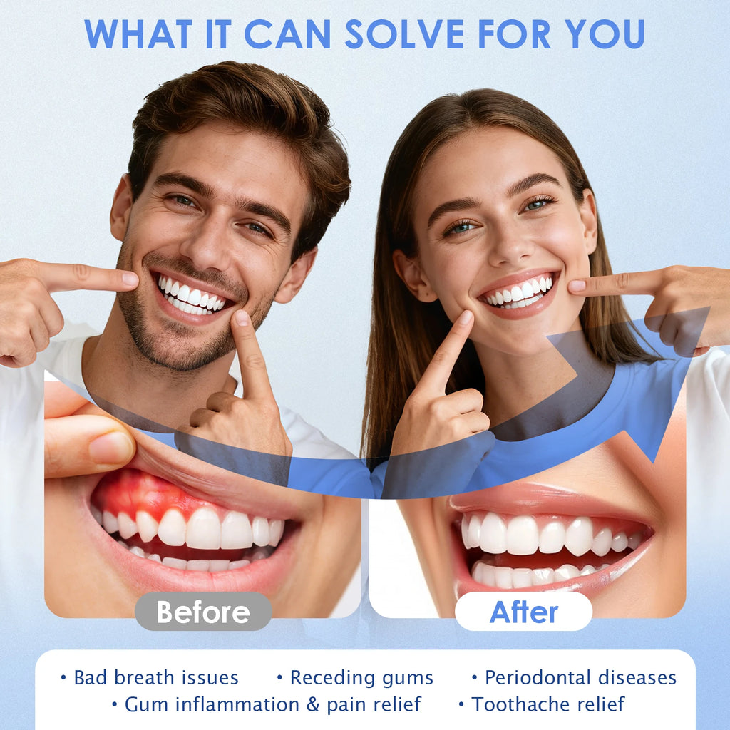 Teeth Whitening Accelerator 650nm Red and Blue LED Light Therapy Device for Gum Health and Oral Care