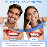 Teeth Whitening Accelerator 650nm Red and Blue LED Light Therapy Device for Gum Health and Oral Care thumbnail 4