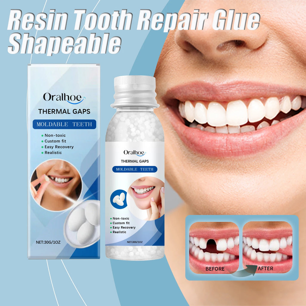Oralhoe Resin Tooth Repair Glue – Shapeable DIY Temporary Tooth Filling & Gap Repair Kit