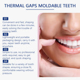 Oralhoe Resin Tooth Repair Glue – Shapeable DIY Temporary Tooth Filling & Gap Repair Kit thumbnail 3