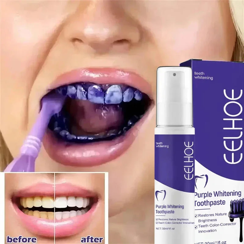 5D Teeth Whitening Toothpaste – Natural Oral Care for Fresh Breath & Stain Removal