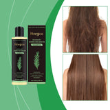 3pcs Rosemary Hair Growth Shampoo Set 100ml – Thickening Hydrolyzed Keratin Formula for Dry, Frizzy & Damaged Hair thumbnail 3
