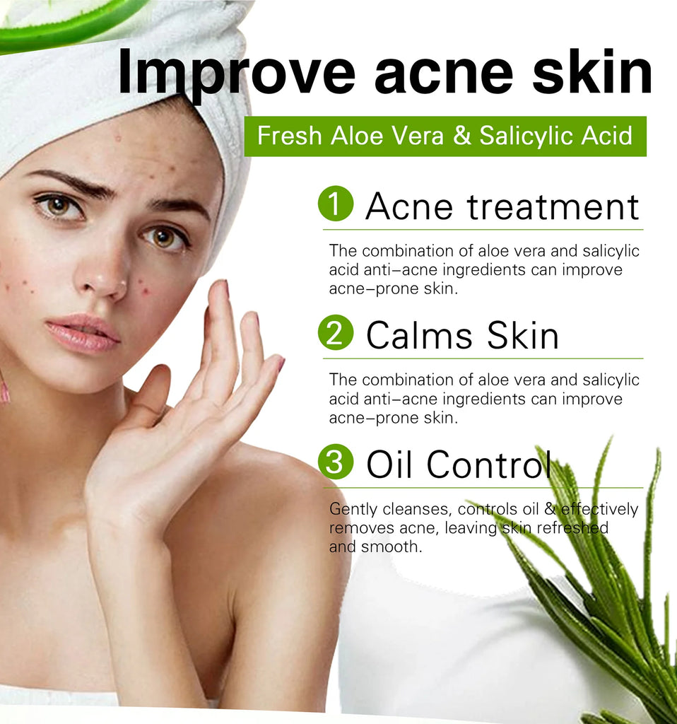 Aloe Brightening Soap Bar 200g – Dark Spot Removal, Acne Control & Oil Balancing for Face and Body