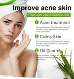 Aloe Brightening Soap Bar 200g – Dark Spot Removal, Acne Control & Oil Balancing for Face and Body thumbnail 8
