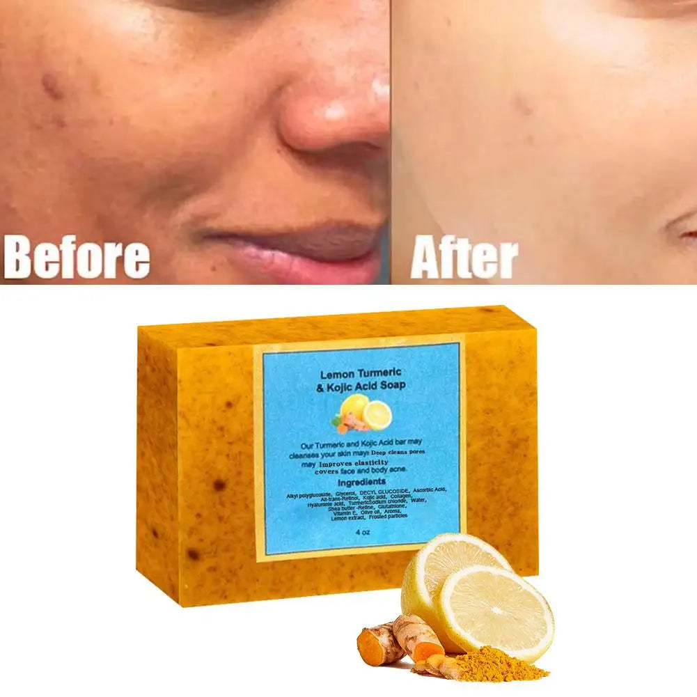 Organic Lemon Turmeric Kojic Acid Soap 100g – Brightening Facial Cleanser for Dark Spots