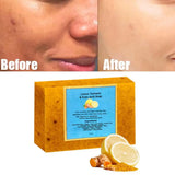 Organic Lemon Turmeric Kojic Acid Soap 100g – Brightening Facial Cleanser for Dark Spots thumbnail 9