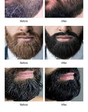 2 Minutes Black Beard Dye Cream with Comb 80ml – Natural Plant-Based Instant Beard & Hair Dye thumbnail 11