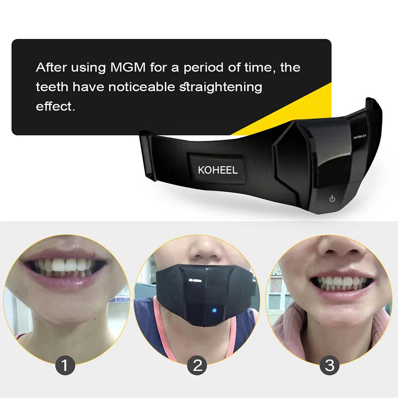 KOHEEL MGM Teeth Straightener with Harmonic Vibration Orthodontic Retainer and Teeth Aligner System – 3 Stage Correction Kit